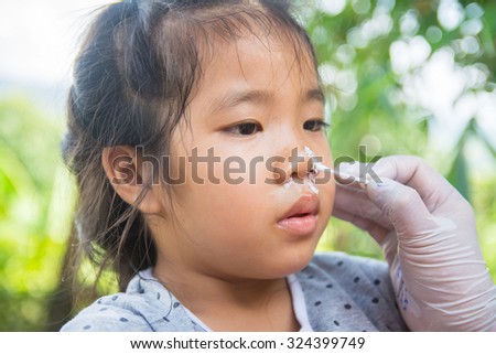 Apply some remedy to the wound on nose of sick little asian girl