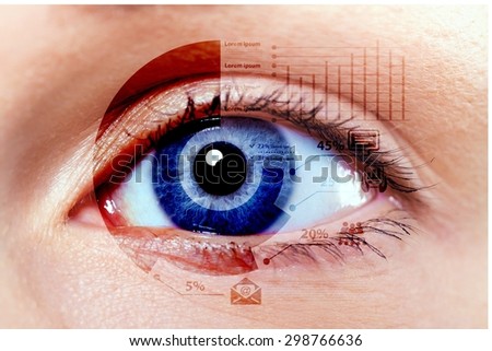 Cataract, eye, vision.