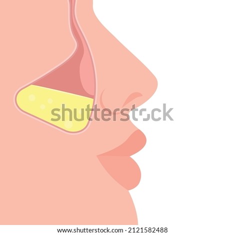 Nasal maxillary sinuses in profile. Part of the face with nose and lips. Vector illustration, flat cartoon color design, isolated on white background, eps 10.