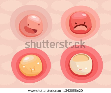 Different stages and emotions of a pimple