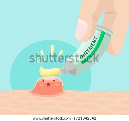 Vector illustration of an ointment being put on a pimple