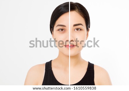 Closeup before after asian woman face. Before-after cosmetic procedures. Skin care wrinkled face, dark circles under eyes. Before-after anti-aging facelift treatment. Facial skincare beauty contouring