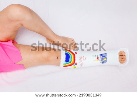 An unrecognizable little girl with a broken leg at home on the bed drew with felt-tip pens on an orthopedic cast. How to have fun with a broken leg. Broken leg in a cast in a small child. ストックフォト © 