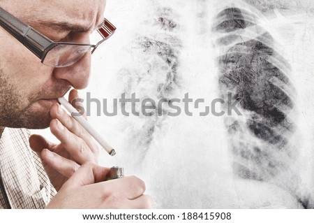 Nervous man is smoking cigarette. Smoking causes lung cancer and other diseases.