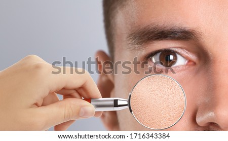 Man with dry skin visiting dermatologist, closeup Foto d'archivio © 