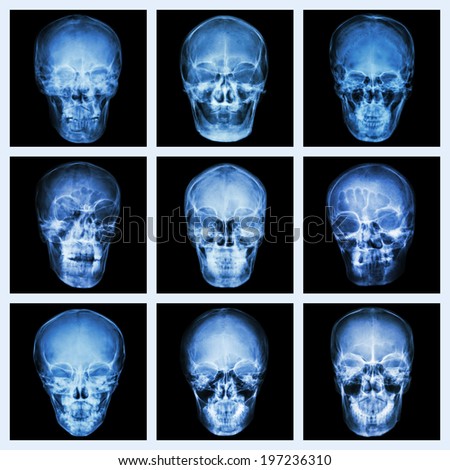 Collection of asian\'s skull