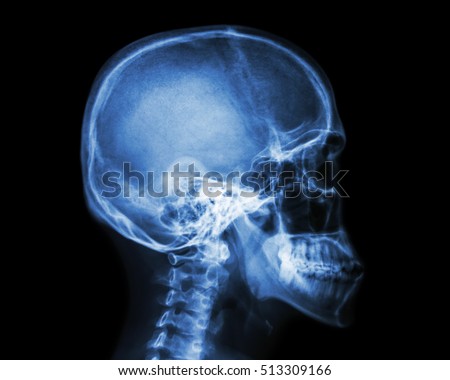Film x-ray skull and cervical spine lateral view Foto d'archivio © 