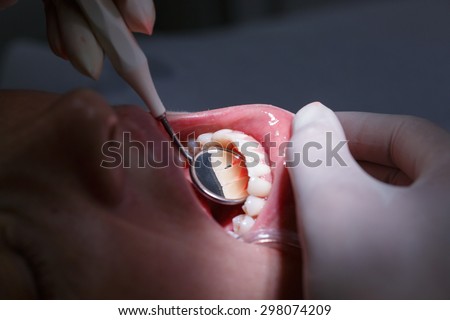Patient at dentists office, getting her white teeth interdental spaces examined with hand-held mirror for tartar and plaque. Dental hygiene, painful procedures and prevention concept.
