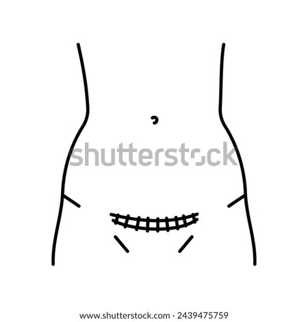 Pfannenstiel incision line icon. Abdominal incisions. Vector isolated element. Editable stroke.