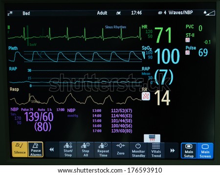 Vital sign monitor in ICU EKG, oxymetry and blood pressure