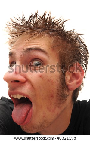 Crazy wacky ugly man with crooked teeth and acne and veins above his eyes sticking out his tounge