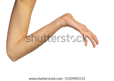 hyperlaxity of the wrist and hand, Marfan, Elher danlos. Imagine de stoc © 