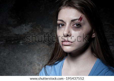 Beaten up woman. Young beaten up woman looking at camera while standing against dark wall