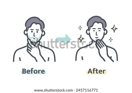 Before and after beard hair removal