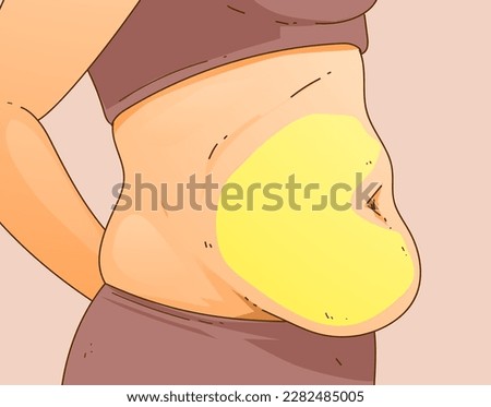 A woman's body with problem areas. Belly fat. Medical infographic. Healthcare illustration. Vector illustration. 