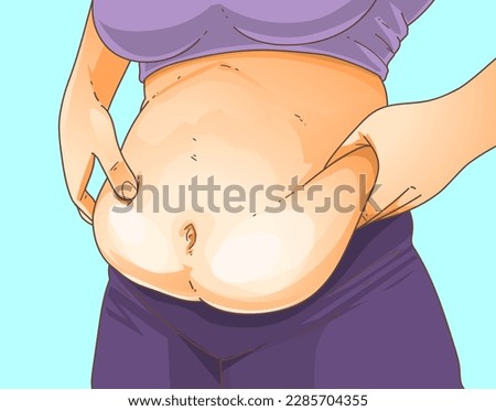 A woman's body with problem areas. Apron belly. Intra-abdominal fat.  Belly fat. Medical infographic. Healthcare illustration. Vector illustration.