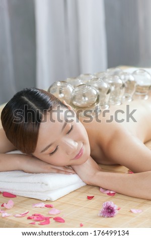 A Chinese medicine cupping of the young lady