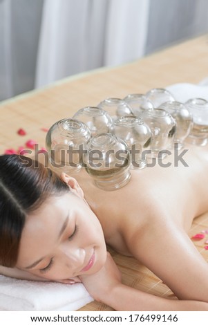 A Chinese medicine cupping of the young lady