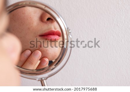 Cropped shot of woman worry about her face when she saw the problem of acne occur on her chin by a mini mirror. Conceptual shot of Acne and problem skin on female face.