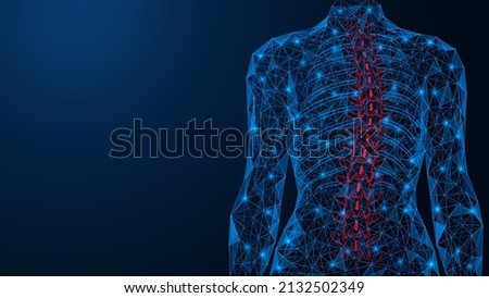 Scoliosis, curvature of the spine. Incorrect deformation of the human back. Polygonal design of interconnected lines and points. Blue background. Foto d'archivio © 