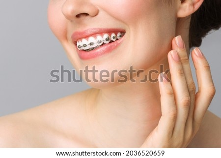 Orthodontic Dental Care Concept. Woman Healthy Smile close up. Closeup Ceramic and Metal Brackets on Teeth. Beautiful Female Smile with Braces. Stock foto © 