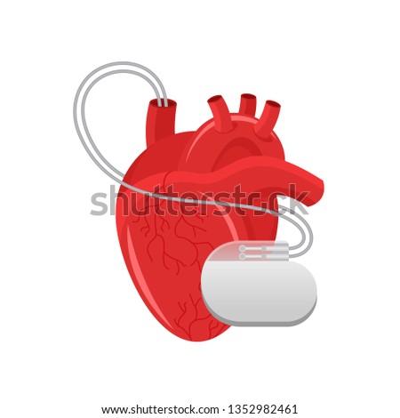 Pacemaker illustration - human heart and cardio implant - vector isolated anatomic medical picture