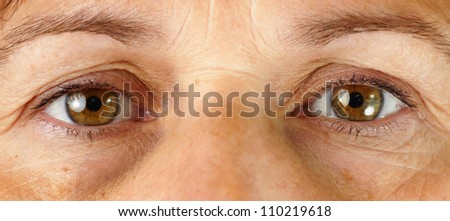 Great detail macro of a very tired or sick middle age woman, with wrinkles, sun damage, veins in the puffy eyes and dark circles under the eyes all showing.