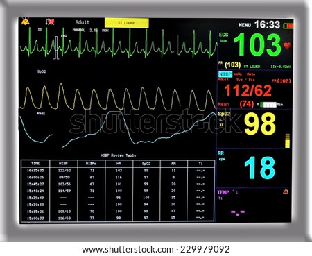 Vital sign monitor in ICU EKG, oxymetry and blood pressure