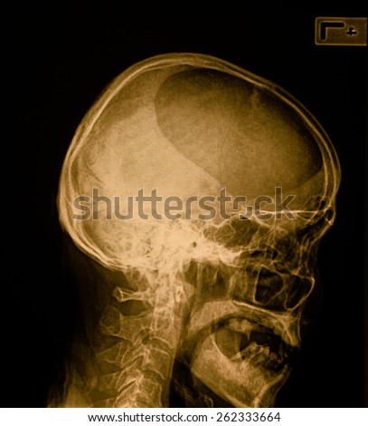 X-ray of head / Many others X-ray images in my portfolio