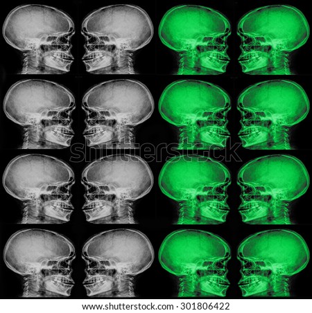 collection of x-ray (head x-ray image)