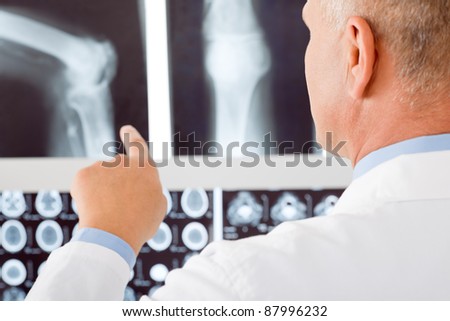 Professional male senior doctor pointing at set of x-rays