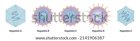Five main types of viruses cause hepatitis: hepatitisviruses A (HAV), B (HBV), C (HCV), D, (HDV) and E (HEV) Stock fotó © 