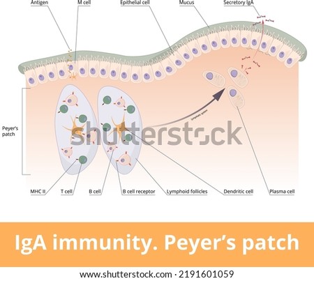 IgA immunity. Peyer’s patch. Lymphoid follicles of the small intestine generate IgA immune response with B cells, T cells, dendritic cells, and plasma cells secreting IgA.