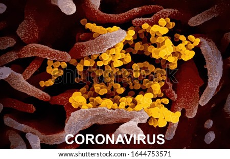 Coronavirus (COVID-19) Real image from Electron Microscope Stok fotoğraf © 