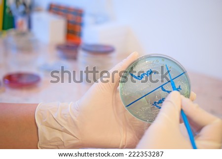 Laboratory doctor holding petri dish with Escherichia Colli. Medical laboratory concept