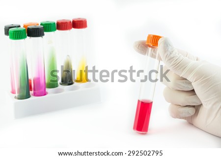 Laboratory doctor hands with sterile gloves holding laboratory test tubes infected with different bacteria isolated on white background