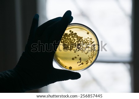 Hand in glove holding Petri dish with bacteria growing in it. Medical tests and research. Bacterial cultures in laboratory glassware.