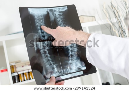 Doctor showing a detail on a x-ray radiography in medical office