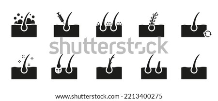 Hair Care and Loss Problem. Hair Cosmetic Silhouette Icons. Shampoo, Dandruff, Haircut, Growth and Alopecia Black Icon. Treatment and Problem of Hair. Isolated Vector illustration.