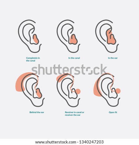 Vector illustration of the types of hearing aids