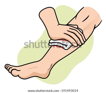 Aid First Stop Bleeding In Leg Stock Vector Illustration 191493014 ...