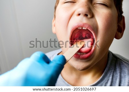 The boy's mouth is wide open with tonsils are enlarged, visible in the white or yellowish tinge on a gray background. Pediatrician checking 8-aged schoolboy's throat applying wooden spatula. Stockfoto © 