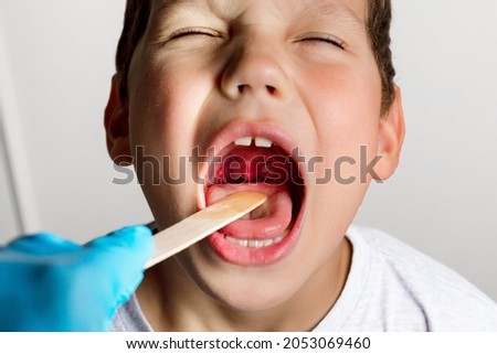 The boy's mouth is wide open with tonsils are enlarged, visible in the white or yellowish tinge on a gray background. Pediatrician checking 8-aged schoolboy's throat applying wooden spatula. Stockfoto © 