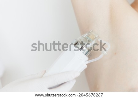 A maniple, a nozzle for a cosmological procedure. Needle rf-lifting. The girl's armpit. Cosmetology and medical services office. Microneedle radio frequency lifting device. Hardware cosmetology. Stok fotoğraf © 