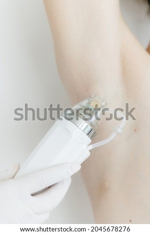 A maniple, a nozzle for a cosmological procedure. Needle rf-lifting. The girl's armpit. Cosmetology and medical services office. Microneedle radio frequency lifting device. Hardware cosmetology. Stok fotoğraf © 