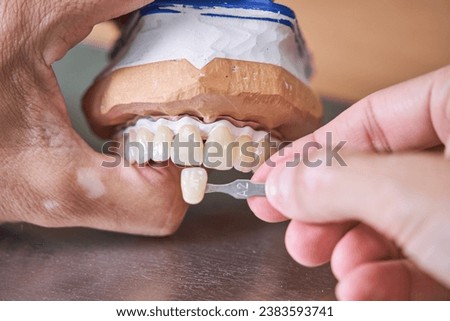 Similar – Image, Stock Photo Dental cast in modern laboratory