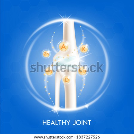Arthritis knee joint. Pain in leg. Human bone anatomy. Skeleton x ray scan concept and Vitamin therapy. Vector EPS10 illustration Foto d'archivio © 