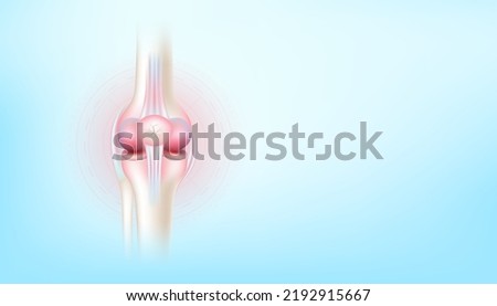 Arthritis knee joint and cartilage osteoarthritis side on blue background with copy space for text. Bone human skeleton anatomy of the body. Medical health care science concept. Realistic 3D Vector.