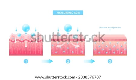 Hyaluronic acid serum drop blue absorbed into the skin cell. Before and after process of getting skin younger with help of moisturizer collagen. Solution for cosmetic advertising. 3D Vector EPS10.