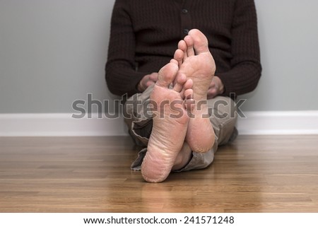 cracked dry feet of a man sitting on the wooden floor